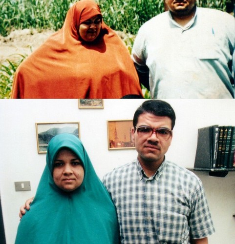 A brother and sister sharing the same eating habits and the same over weight status. Mona was married and could not have babies because of her over weight (infertility). She was concerned by the effect of surgery on child bearing. We reassured her that surgically induced weight loss actually increases her chances for fertility and pregnancy outcome. 6 months after surgery she got pregnant  and gave birth to a healthy baby girl. 